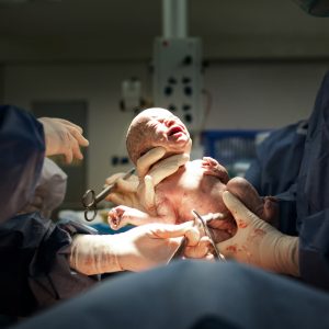 Naissance-par-le-ventre-mon experience-de-la-cesarienne-article-blog-passion-maternite